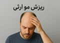 ریزش مو ارثی