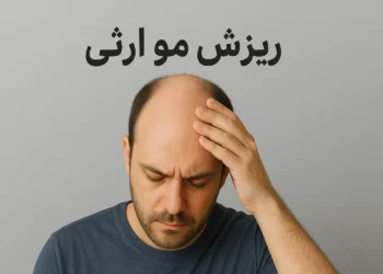 ریزش مو ارثی