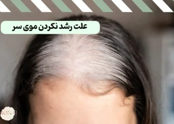 ۱۰ علت رشد نکردن موی سر