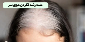۱۰ علت رشد نکردن موی سر