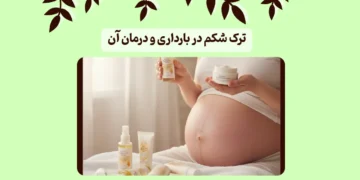ترک شکم در بارداری